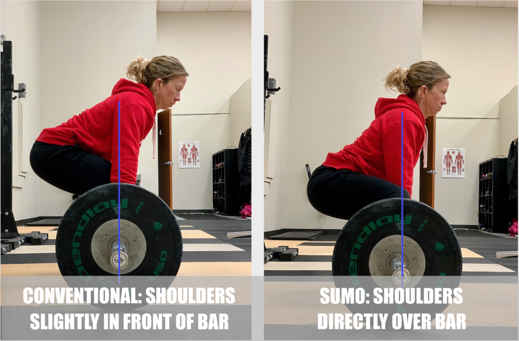 Conventional or Sumo Deadlift?